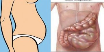 Vous n’êtes pas gras! Votre estomac est gonflé et voici comment s’en débarrasser!